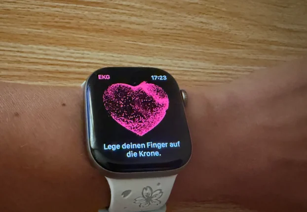 Как часто и точно Apple Watch измеряет сердечный ритм